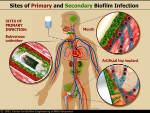 One biofilm reach the bloodstream they can spread to any moist surface of the human body. Source: Center for Biofilm Engineering, Montana State University-Bozeman